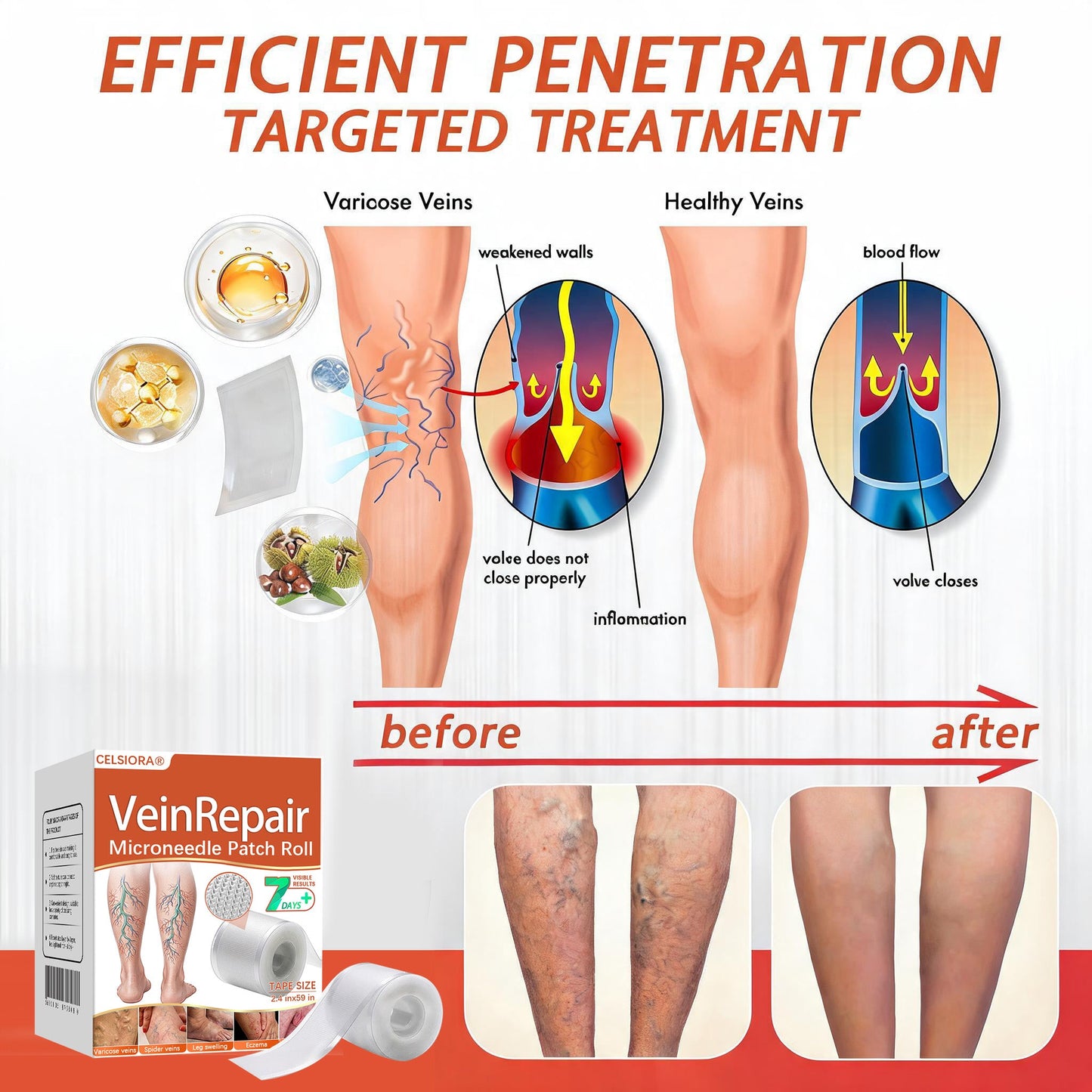 🧚🧚Last Day Promotion 50% OFF - Celsiora® Vein Ease Microneedle Care Patch