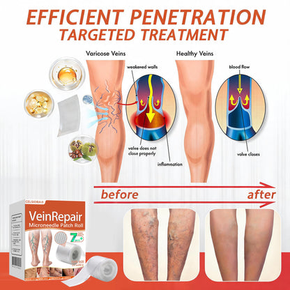 🧚🧚Last Day Promotion 50% OFF - Celsiora® Vein Ease Microneedle Care Patch