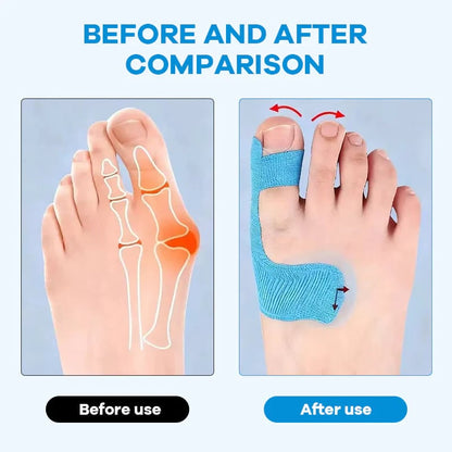 🔥💞LAST DAY 75% OFF ✨Bunion Relief Toe Correction Wrap