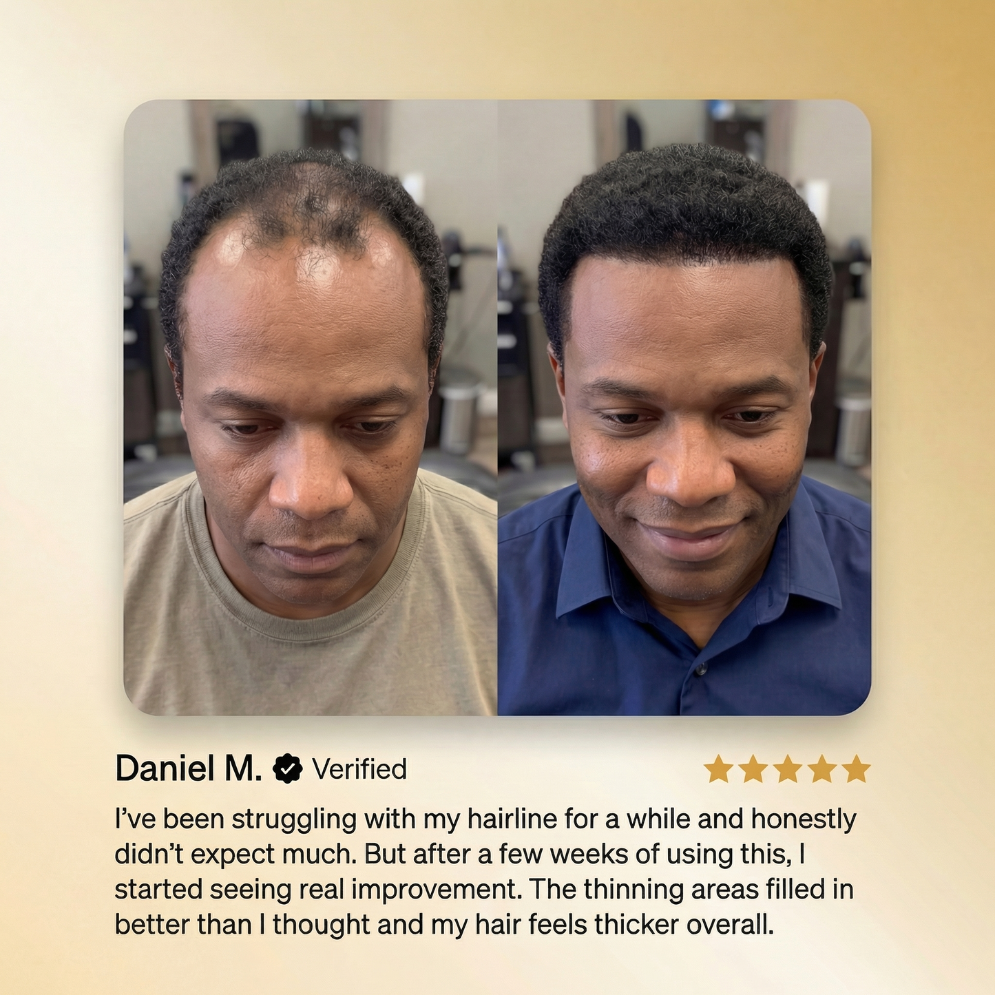 HUDROS® Advanced Batana Hair Regrowth Therapy 🔥 50% OFF
