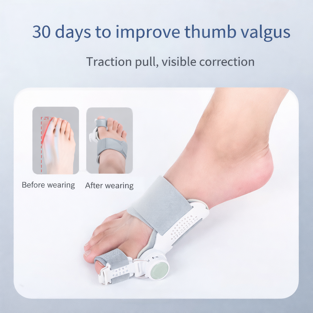 🔥LAST DAY 75% OFF 💞✨Nawaru® Bunion Corrector