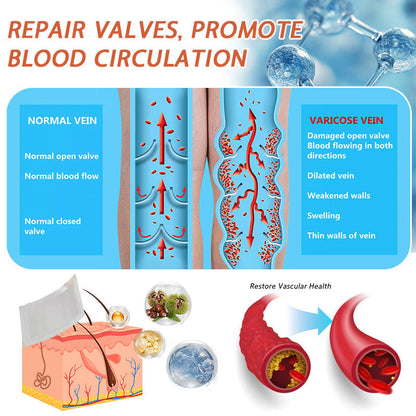🧚🧚Last Day Promotion 50% OFF - Celsiora® Vein Ease Microneedle Care Patch