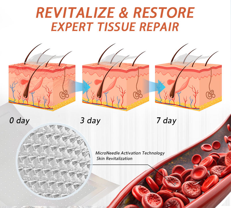 🧚🧚Last Day Promotion 50% OFF - Celsiora® Vein Ease Microneedle Care Patch