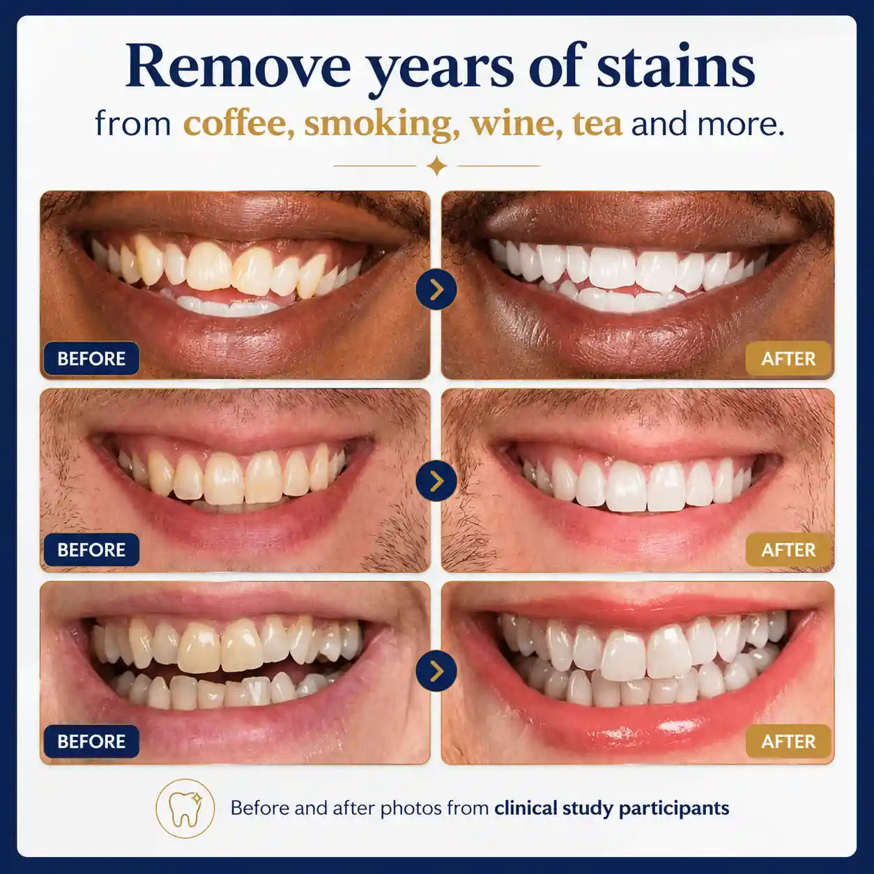 ✨ 🔥HEATWOLF® Pro Gold Whitening Pen – A Brighter-Looking Smile Starts Here | 50% OFF Today