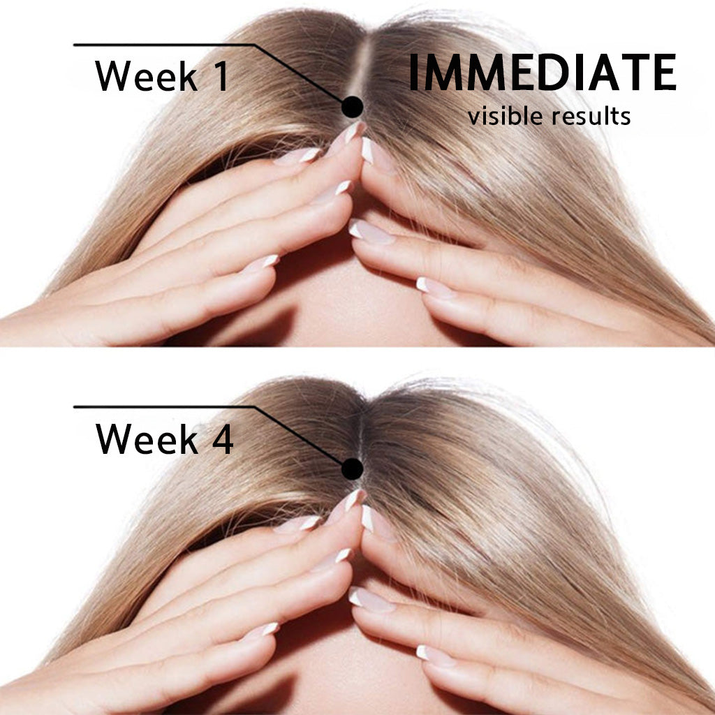 👨‍⚕️👨‍⚕️ Official Store | 🔥Beddys® Highly Effective Biotin & Rosemary Hair Growth Serum — Visibly fills thinning areas & receding hairlines (🔥 Limited-Time Offer, ⏳ Last 30 Minutes)
