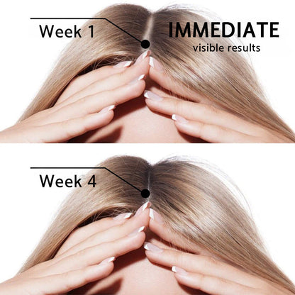 👨‍⚕️👨‍⚕️ Official Store | 🔥Beddys® Highly Effective Biotin & Rosemary Hair Growth Serum — Visibly fills thinning areas & receding hairlines (🔥 Limited-Time Offer, ⏳ Last 30 Minutes)