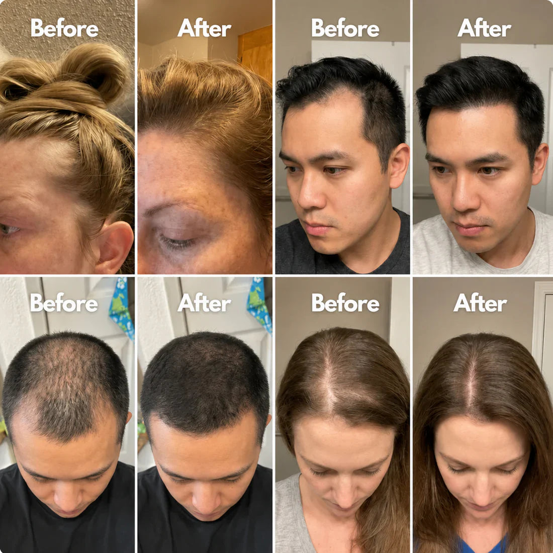 Rolimey® Advanced Hair Growth Roll-On Serum