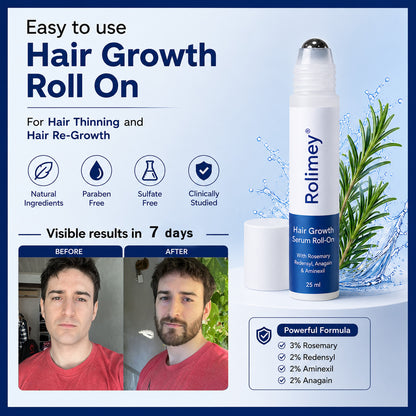Rolimey® Advanced Hair Growth Roll-On Serum