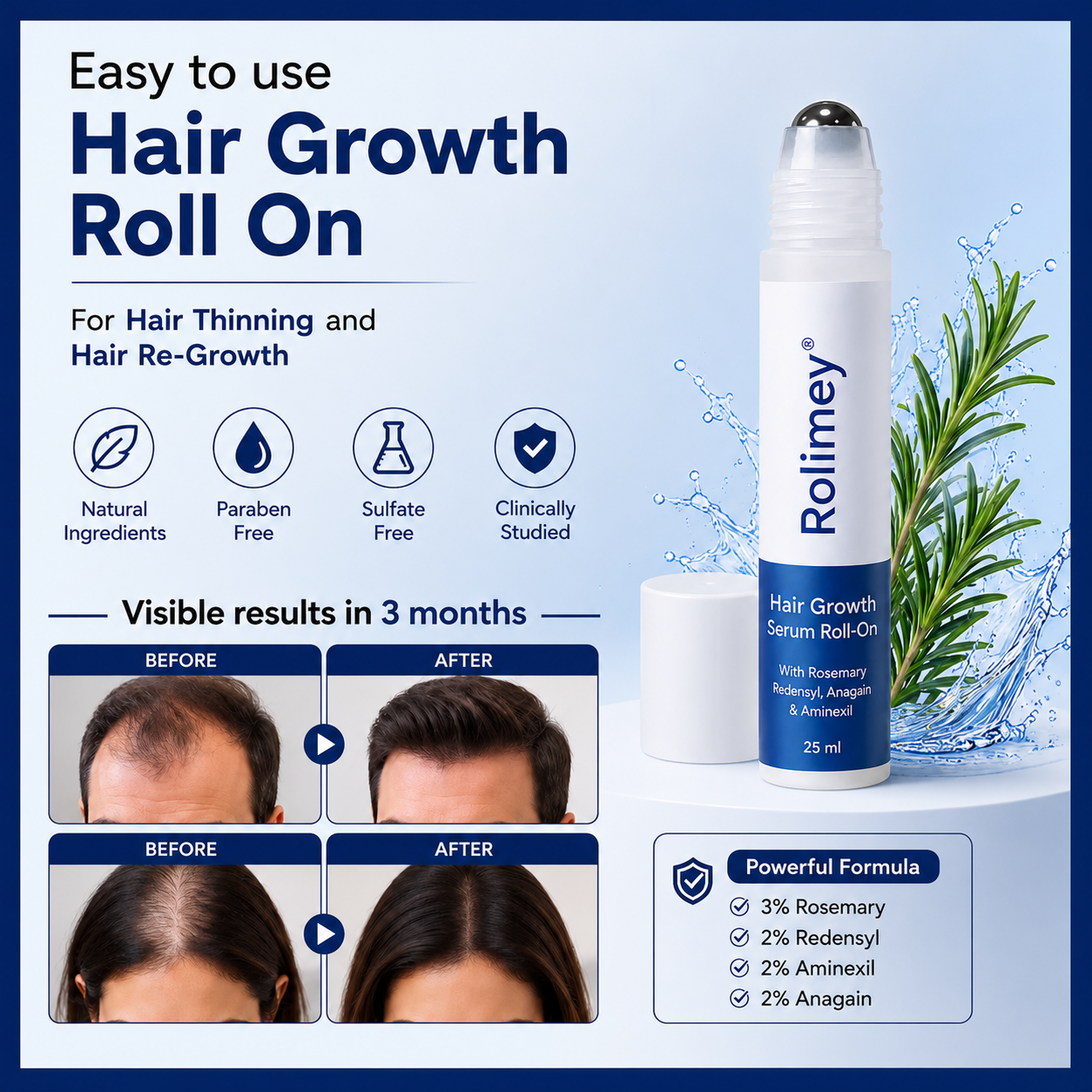Rolimey® Advanced Hair Growth Roll-On Serum