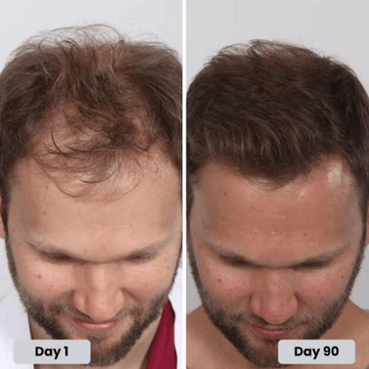 🔥HOT SALE 50% OFF🔥Red light hair growth CAP — Regrow Thicker Hair in 90 Days