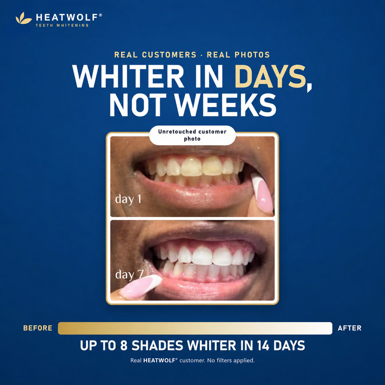 ✨ 🔥HEATWOLF® Pro Gold Whitening Pen – A Brighter-Looking Smile Starts Here | 50% OFF Today