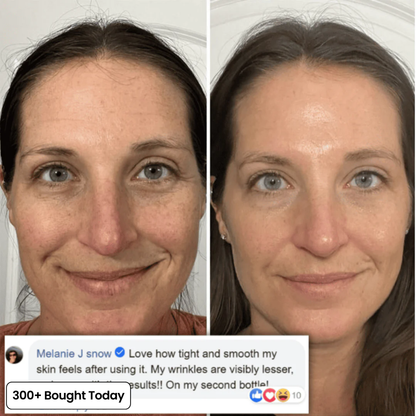 💞LAST DAY 50% OFF ✨Collagen Plump & Repair Balm