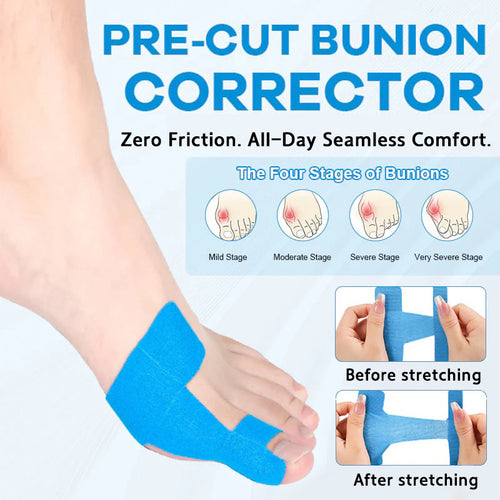 🔥💞LAST DAY 75% OFF ✨Bunion Relief Toe Correction Wrap