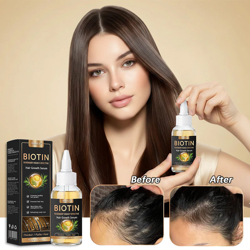 👨‍⚕️👨‍⚕️ Official Store | 🔥Beddys® Highly Effective Biotin & Rosemary Hair Growth Serum — Visibly fills thinning areas & receding hairlines (🔥 Limited-Time Offer, ⏳ Last 30 Minutes)