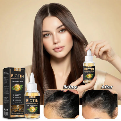 👨‍⚕️👨‍⚕️ Official Store | 🔥Beddys® Highly Effective Biotin & Rosemary Hair Growth Serum — Visibly fills thinning areas & receding hairlines (🔥 Limited-Time Offer, ⏳ Last 30 Minutes)