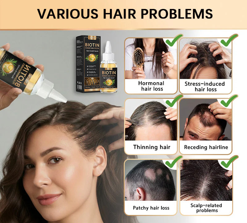 👨‍⚕️👨‍⚕️ Official Store | 🔥Beddys® Highly Effective Biotin & Rosemary Hair Growth Serum — Visibly fills thinning areas & receding hairlines (🔥 Limited-Time Offer, ⏳ Last 30 Minutes)